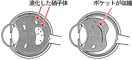 メカニズム